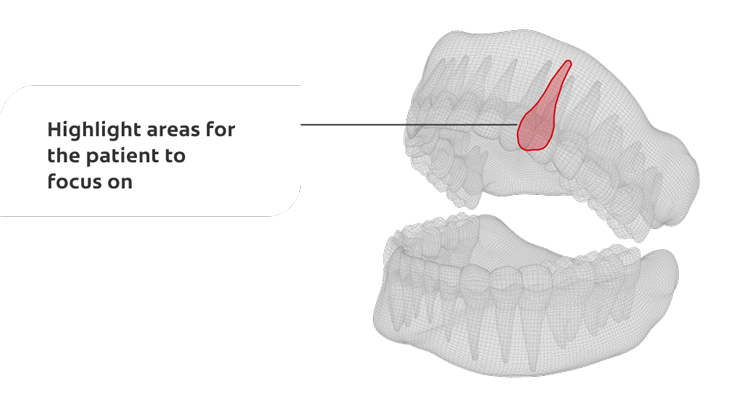 Highlight areas for the patient to focus on