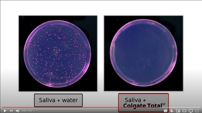 two images side by side comparing bacteria Petri dishes with saliva and water, and saliva and Colgate total