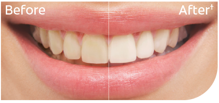 Before and after smile image
