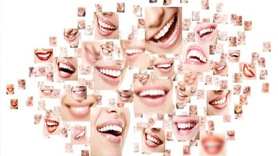 a collage of women showing teeth while smiling close-ups