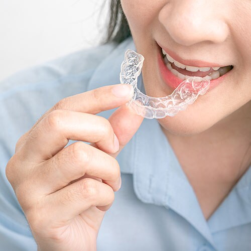 Woman wearing orthodontic silicone trainer mobile