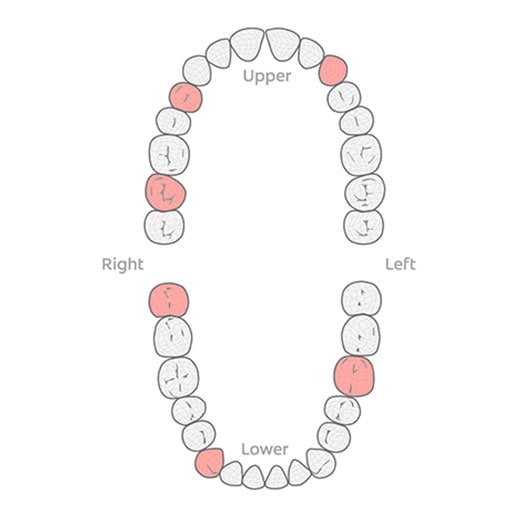 human teeth diagram with some teeth colored in red 