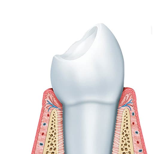 anatomy of the tooth image 